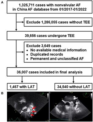 Left Atrial Thrombus in Patients With Non-valvular Atrial Fibrillation: A Cross-Sectional Study in China